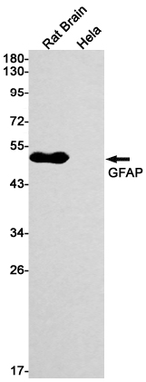 GFAP Rabbit mAb