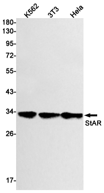 StAR Rabbit mAb