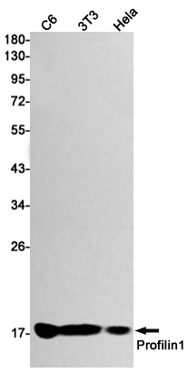 Profilin 1 Rabbit mAb