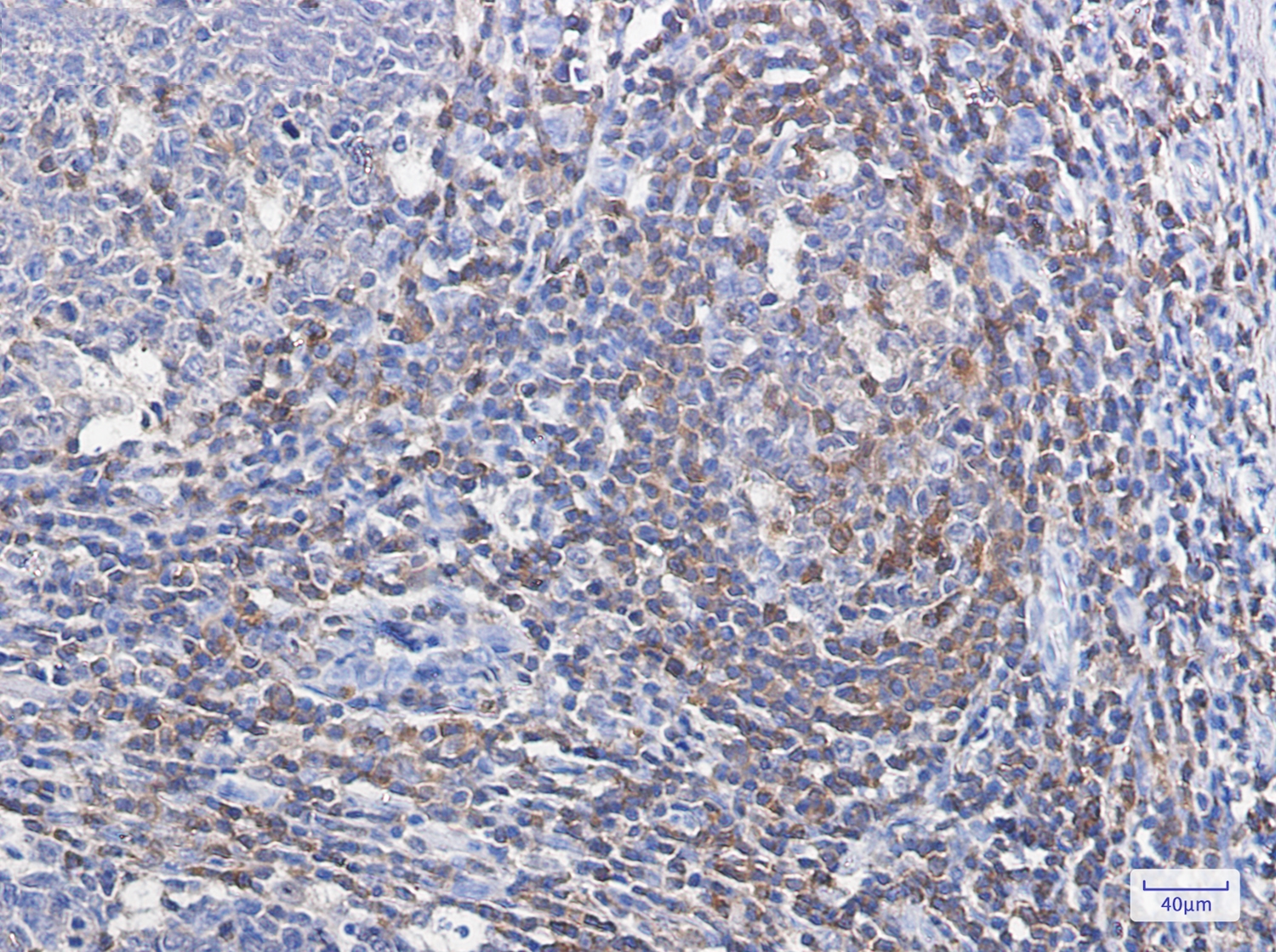 Profilin 1 Rabbit mAb