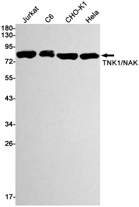 TBK1 Rabbit mAb