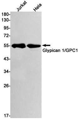 Glypican 1 Rabbit mAb