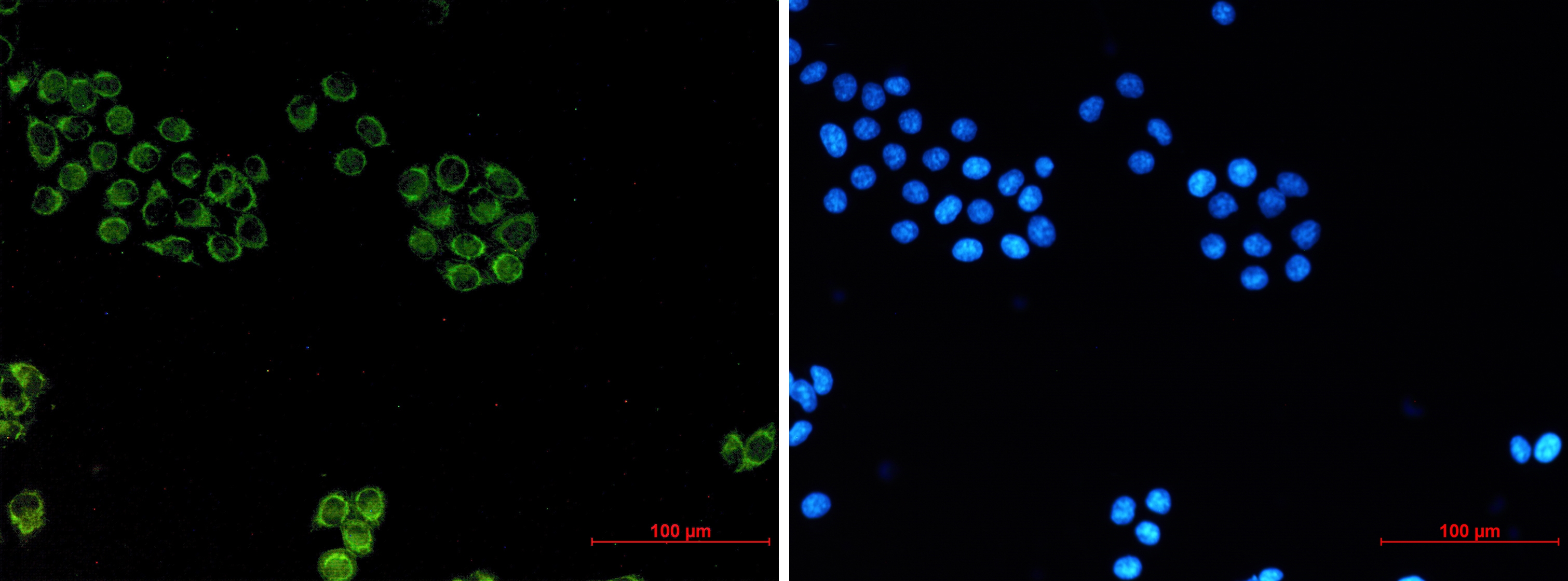 Glypican 1 Rabbit mAb