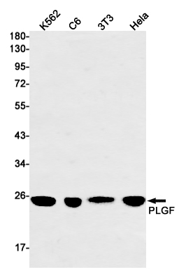 PLGF Rabbit mAb