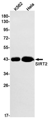 SIRT2 Rabbit mAb