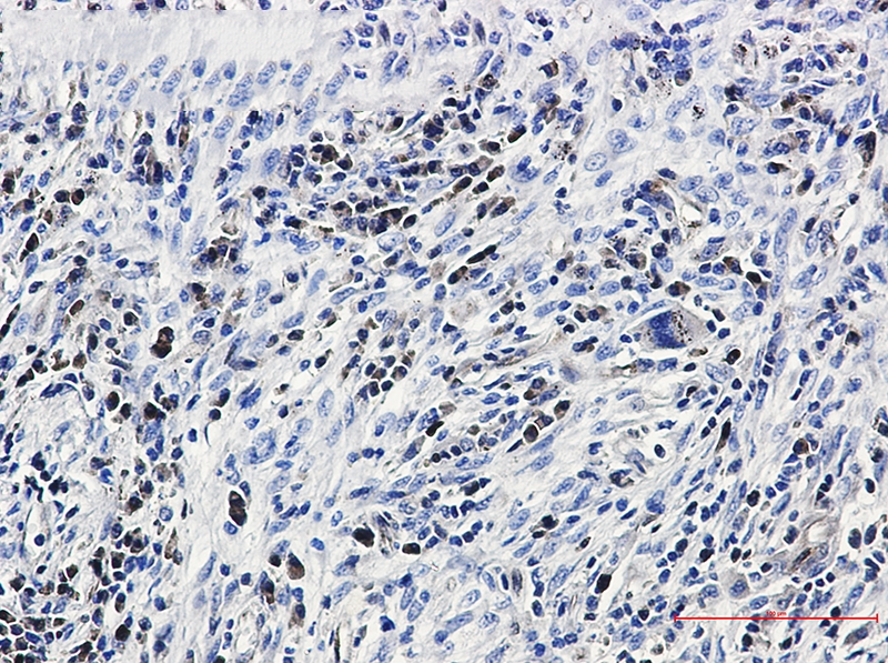 Caspase 3 Rabbit mAb