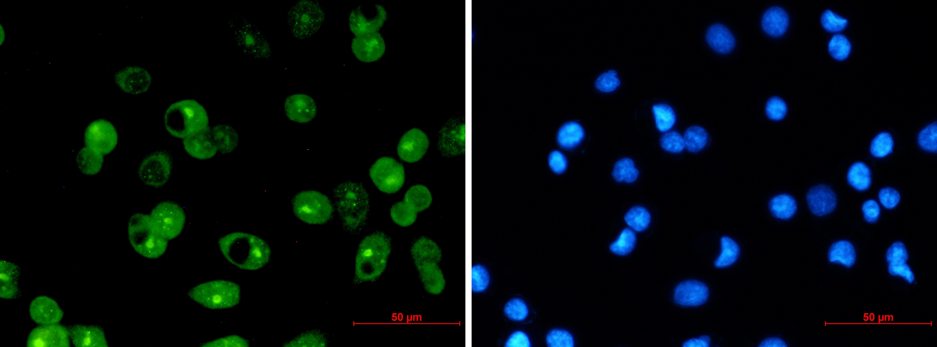 MCL1 Rabbit mAb