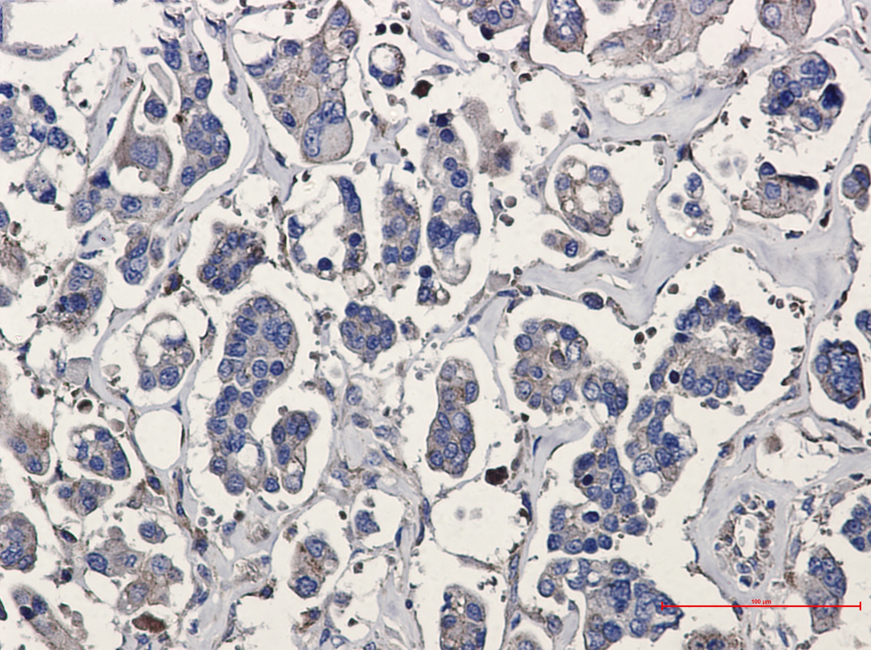 p16 ARC Rabbit mAb