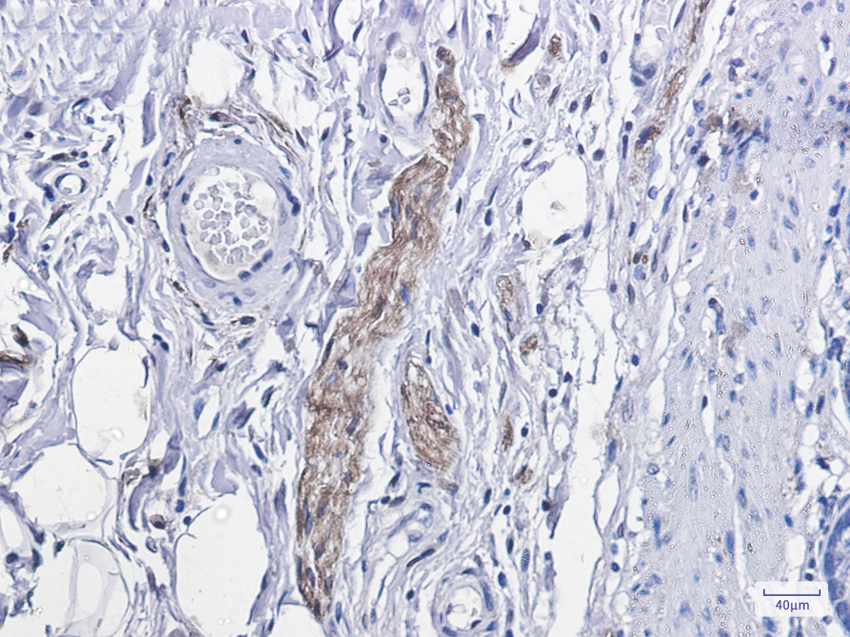 Phospho-PKC alpha (Thr638) Rabbit mAb