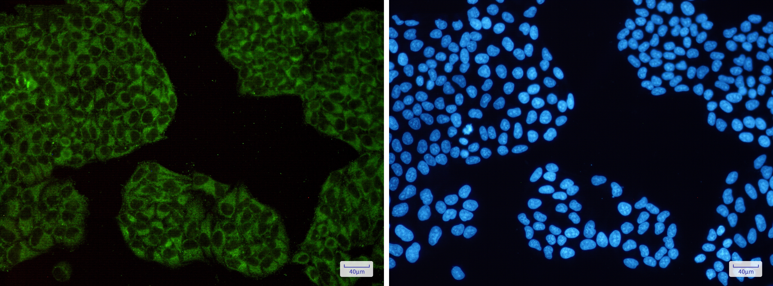 Ferritin Heavy Chain Rabbit mAb