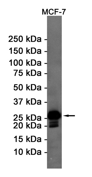 Bcl2 Rabbit mAb