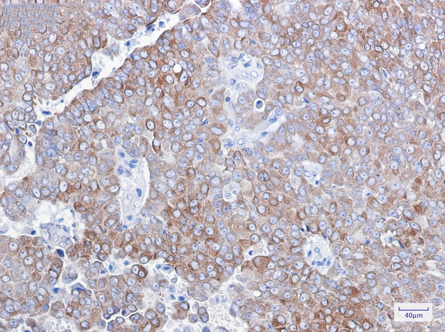 Bcl2 Rabbit mAb