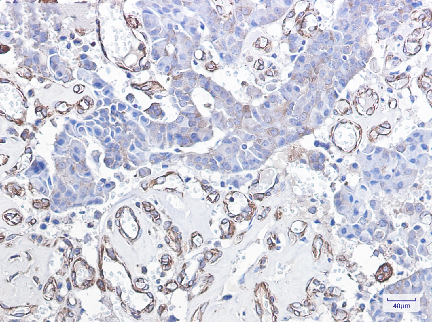 DDIT3 Rabbit mAb