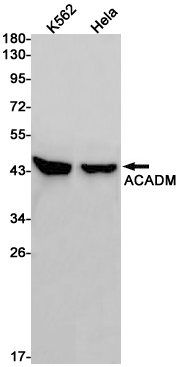 ACADM Rabbit mAb