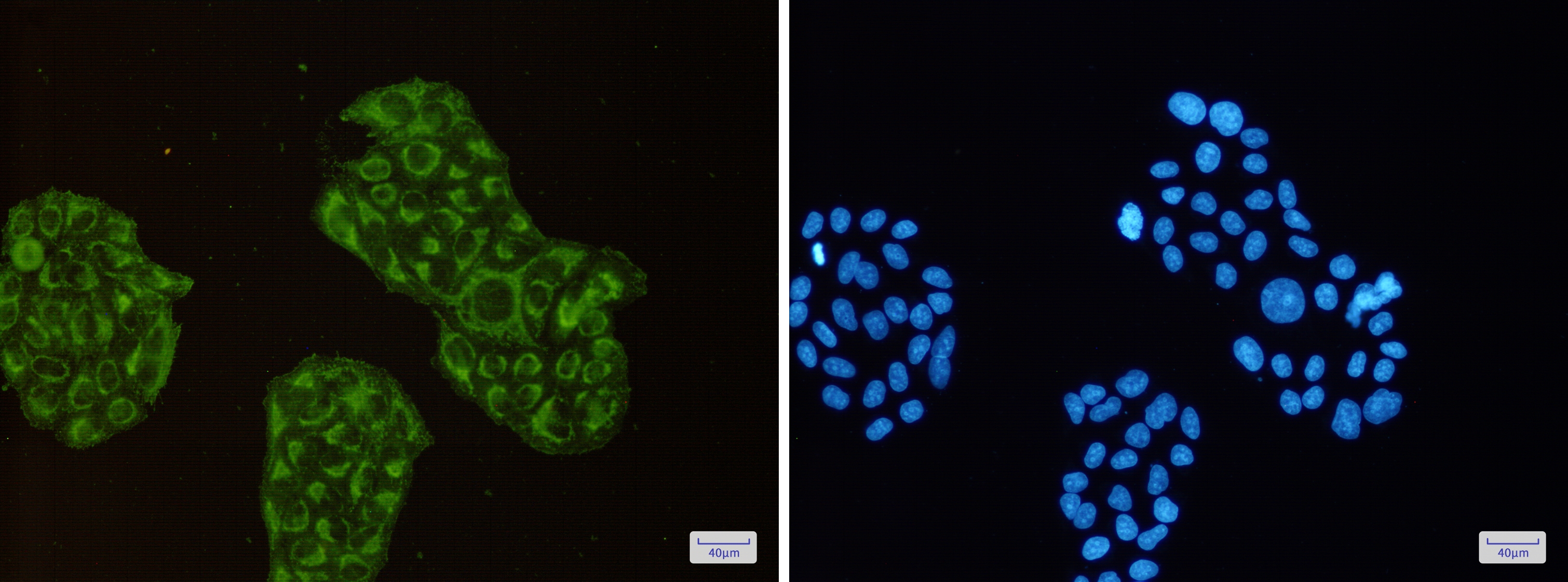 ACADM Rabbit mAb