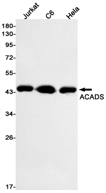 ACADS Rabbit mAb