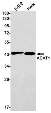 ACAT1 Rabbit mAb