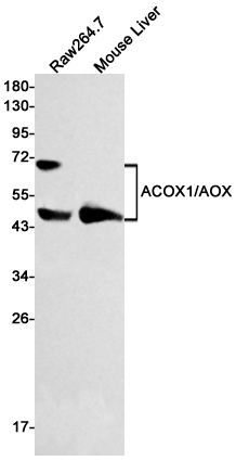 ACOX1 Rabbit mAb