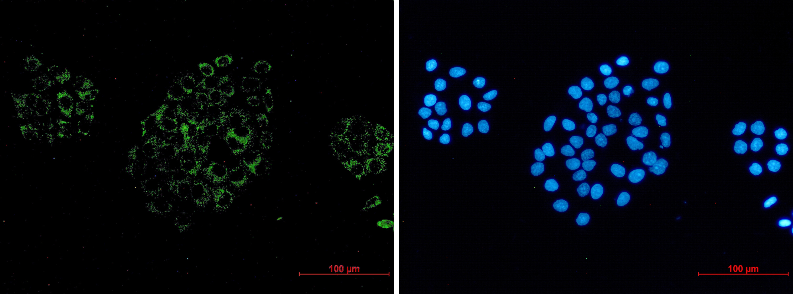 ACOX1 Rabbit mAb