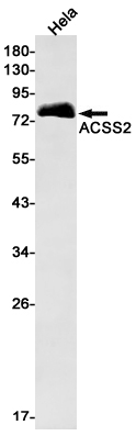 ACSS2 Rabbit mAb