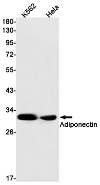 Adiponectin Rabbit mAb