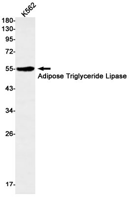 Adipose Triglyceride Lipase Rabbit mAb