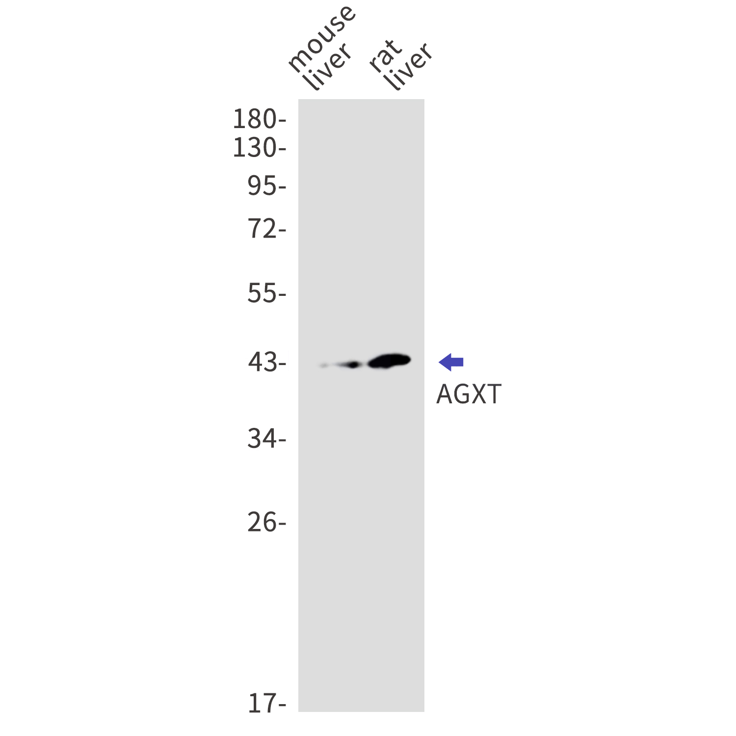 AGXT Rabbit mAb