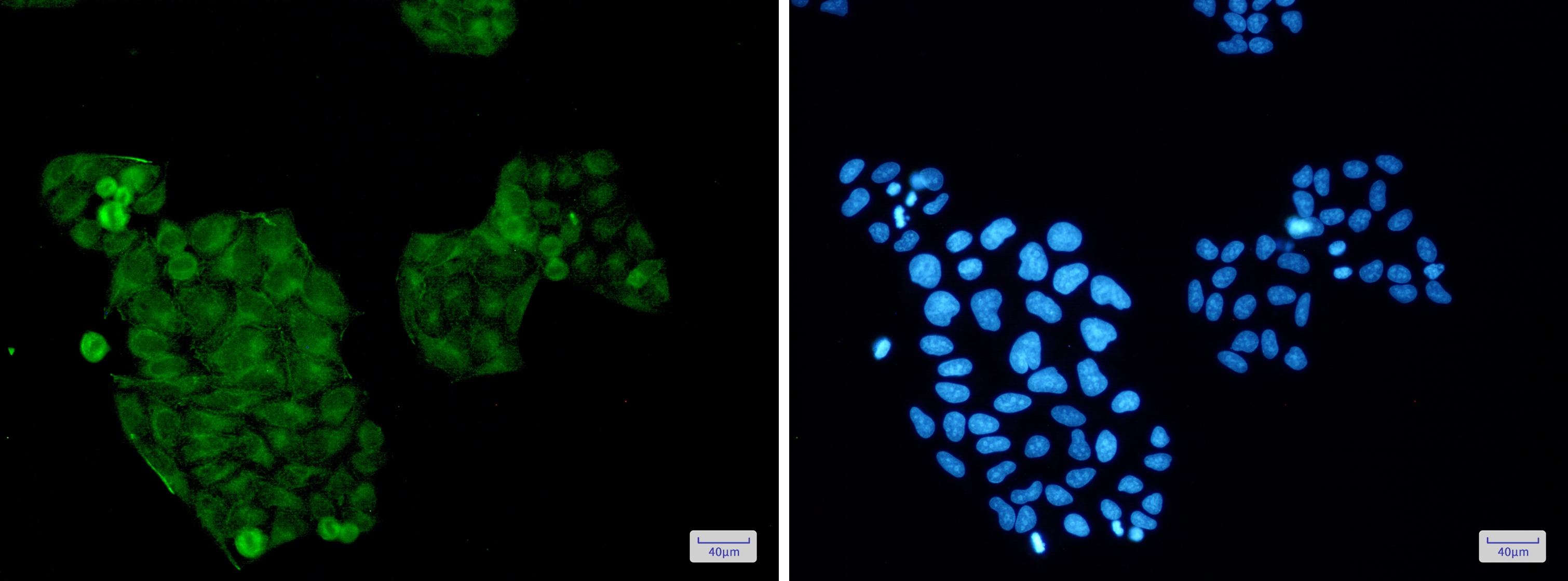 AKT Rabbit mAb