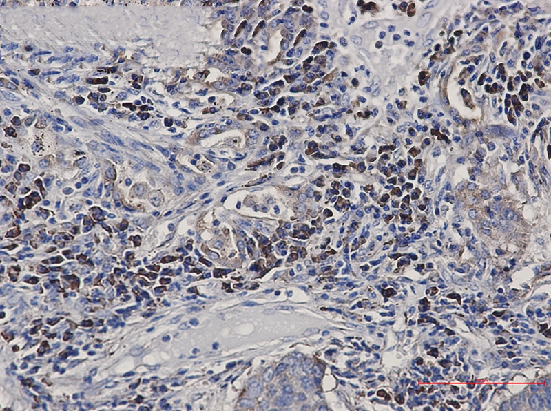 Alkaline Phosphatase Rabbit mAb