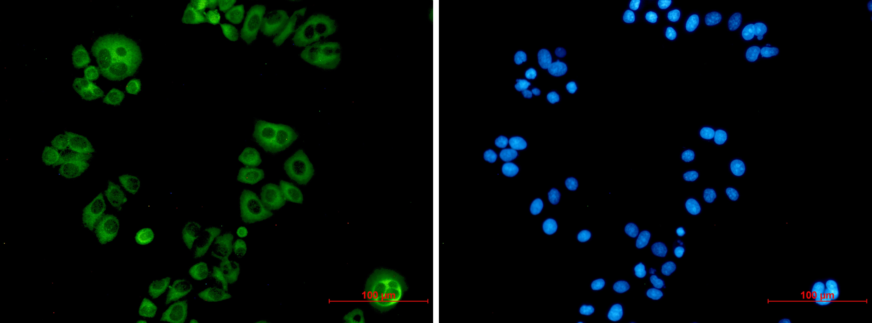 Alkaline Phosphatase Rabbit mAb