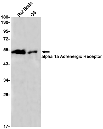 alpha 1a Adrenergic Receptor Rabbit mAb