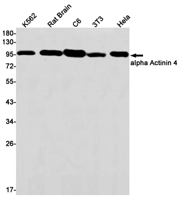 alpha Actinin 4 Rabbit mAb