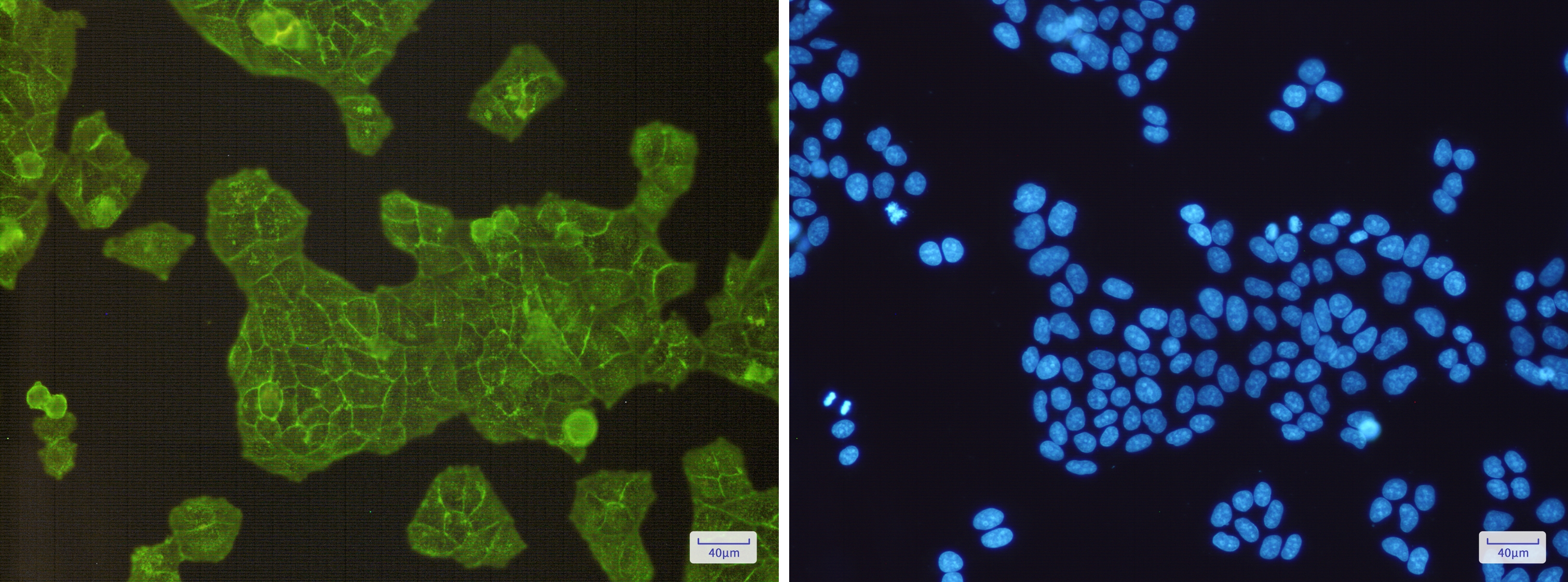 alpha Actinin 4 Rabbit mAb