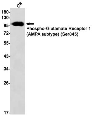 Phospho-Glutamate Receptor 1 (AMPA Subtype) (Ser845) Rabbit mAb