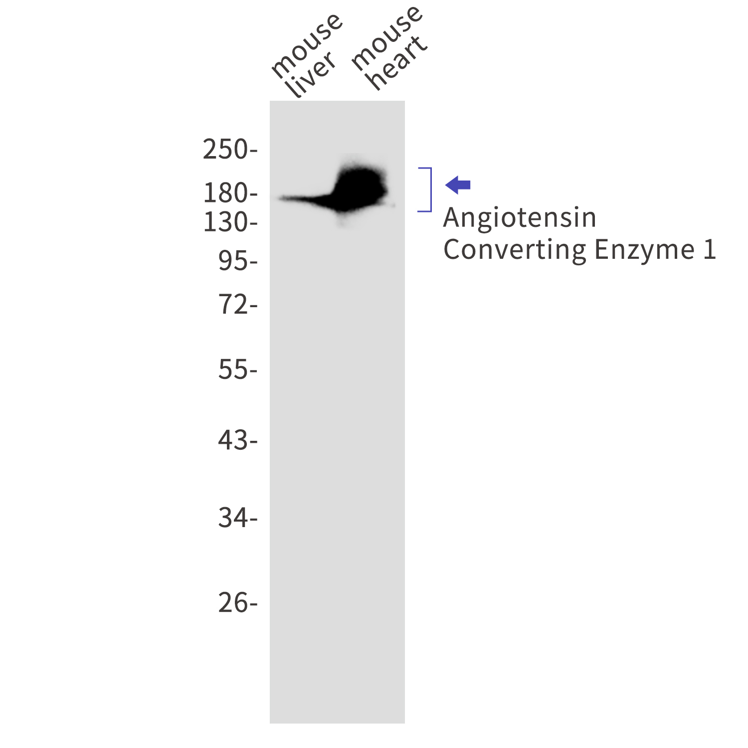 Angiotensin Converting Enzyme 1 Rabbit mAb