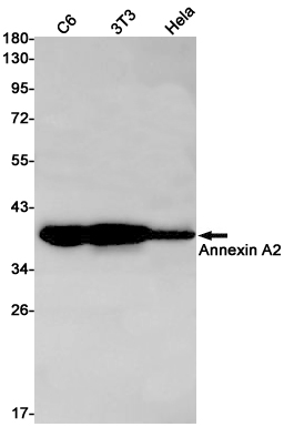 Annexin A2 Rabbit mAb