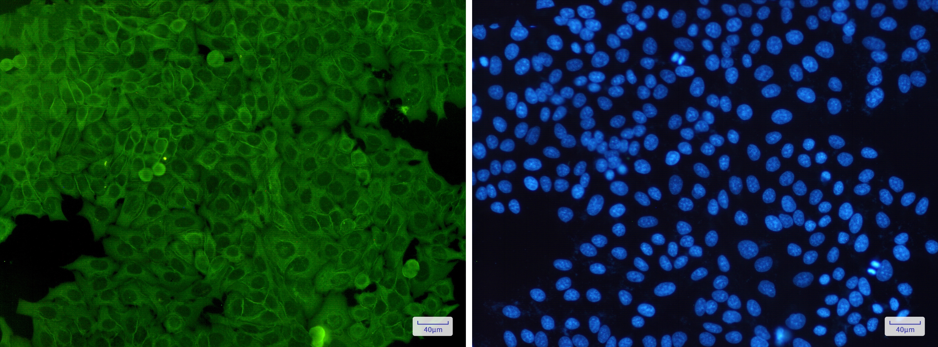 Annexin A2 Rabbit mAb