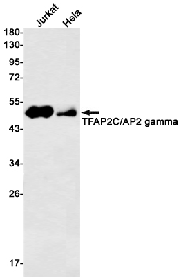 Transcription Factor AP 2 gamma Rabbit mAb