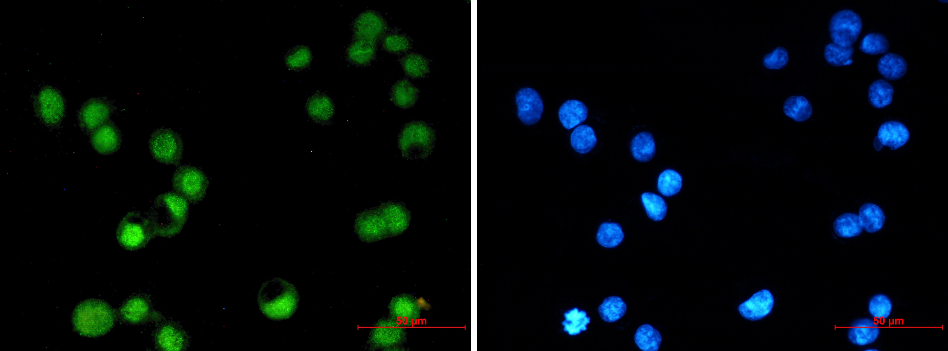 Transcription Factor AP 2 gamma Rabbit mAb