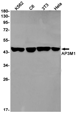 AP3M1 Rabbit mAb