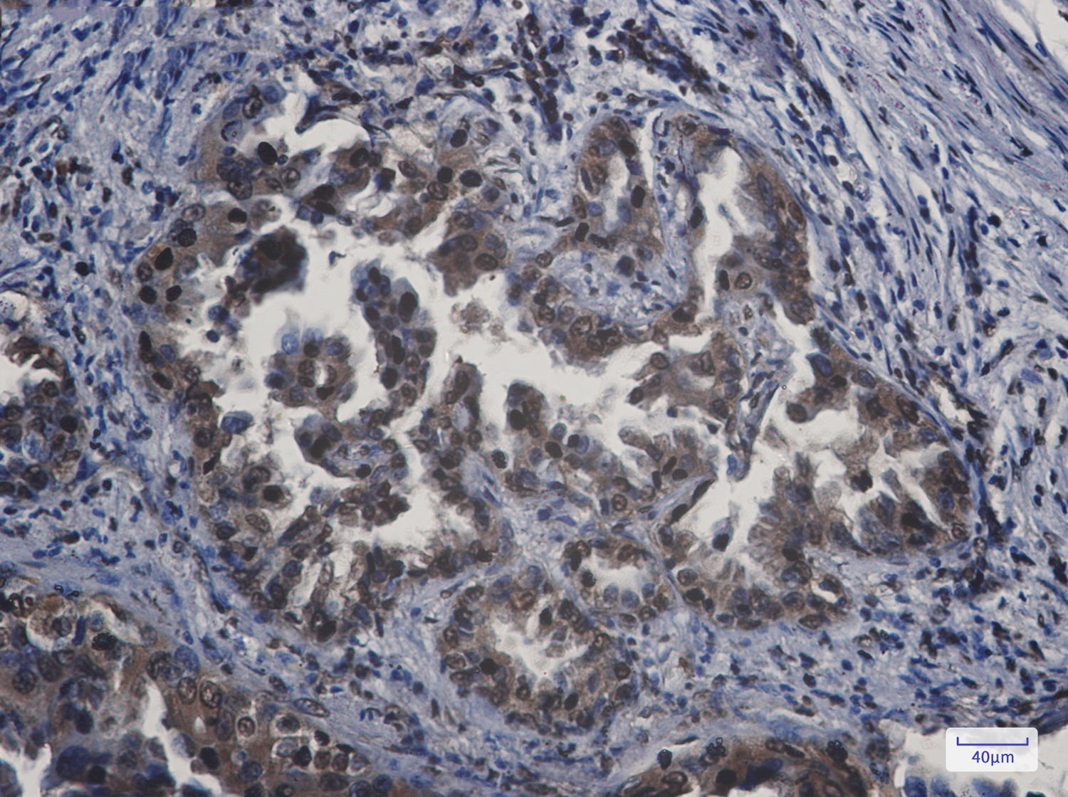 APPL Rabbit mAb