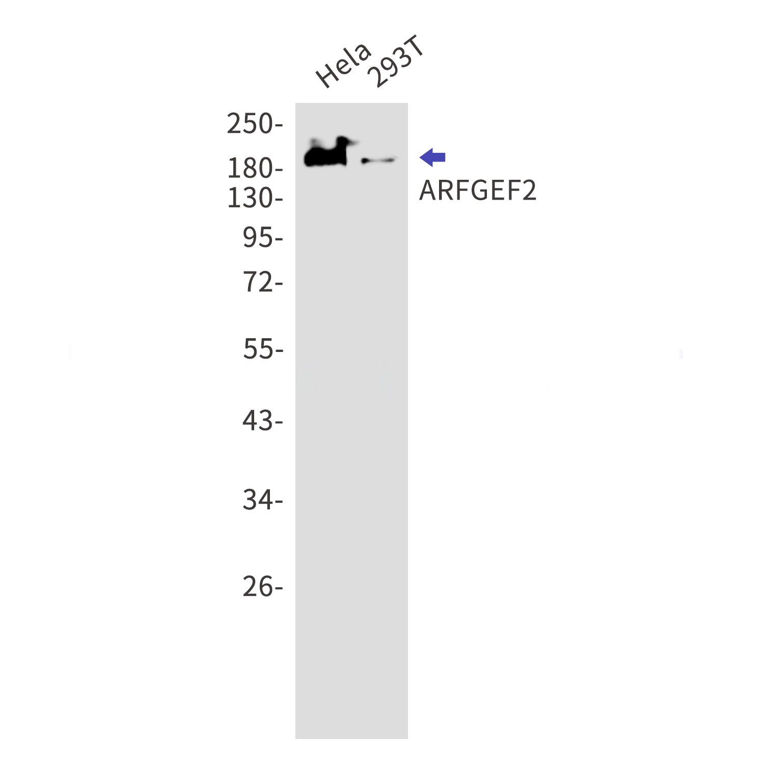 ARFGEF2 Rabbit mAb