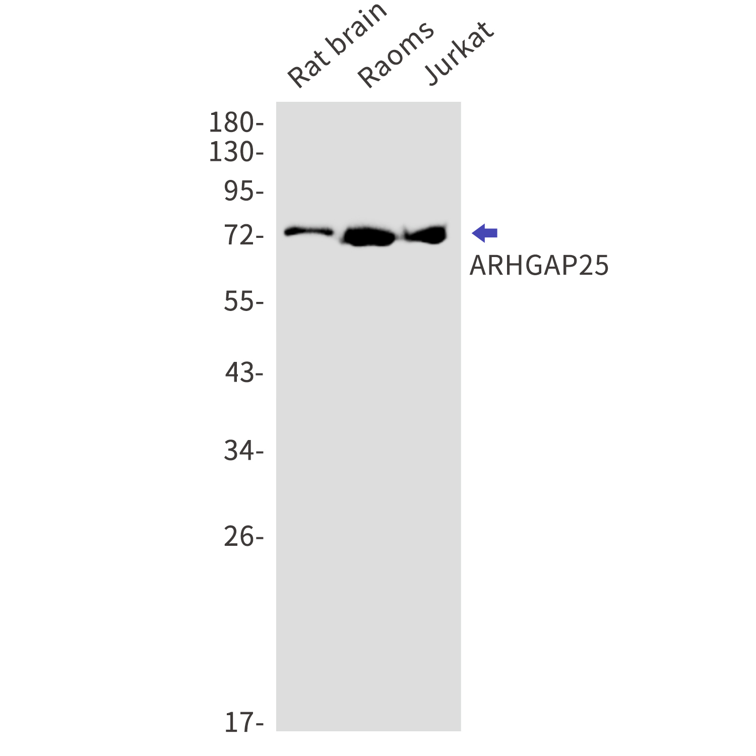 ARHGAP25 Rabbit mAb