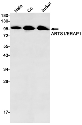 ERAP1 Rabbit mAb