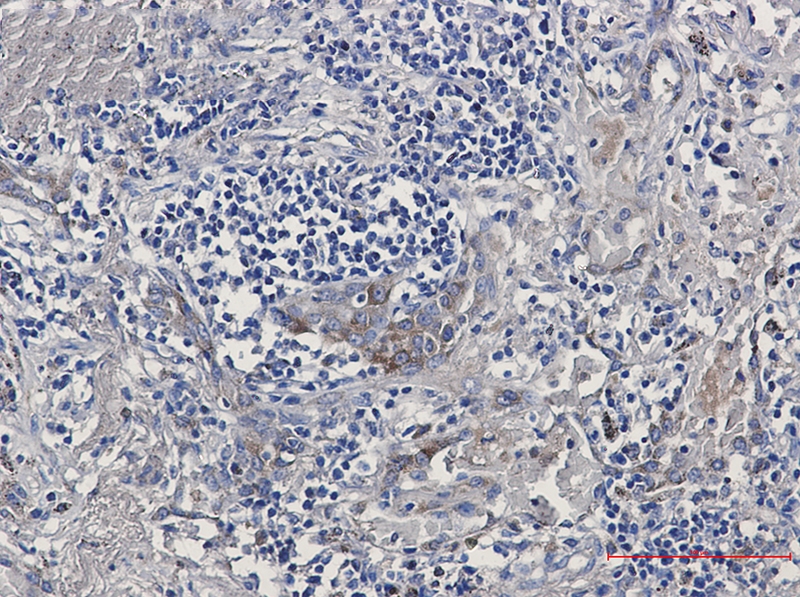 ERAP1 Rabbit mAb