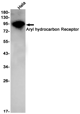 Aryl Hydrocarbon Receptor Rabbit mAb