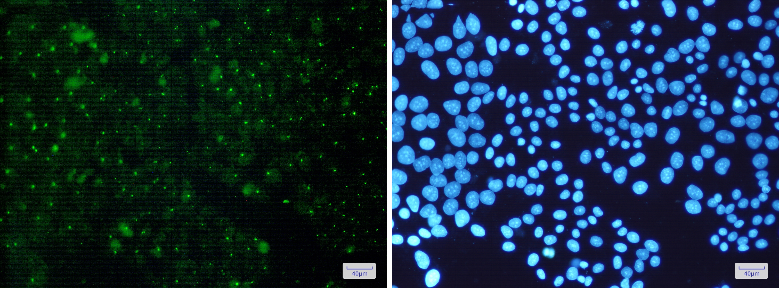 Aryl Hydrocarbon Receptor Rabbit mAb