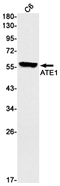 ATE1 Rabbit mAb