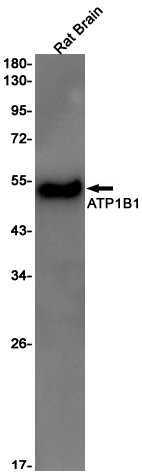 ATP1B1 Rabbit mAb