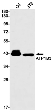 ATP1B3 Rabbit mAb